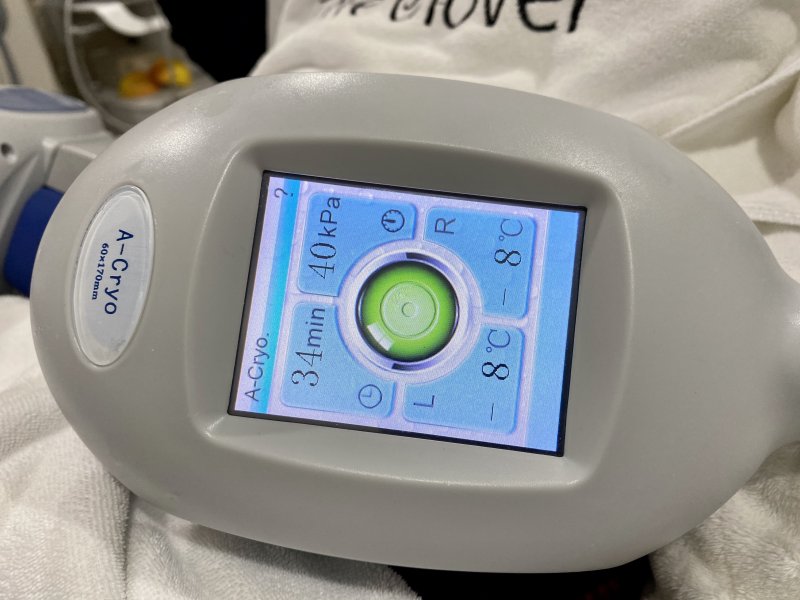 Fat Freezing